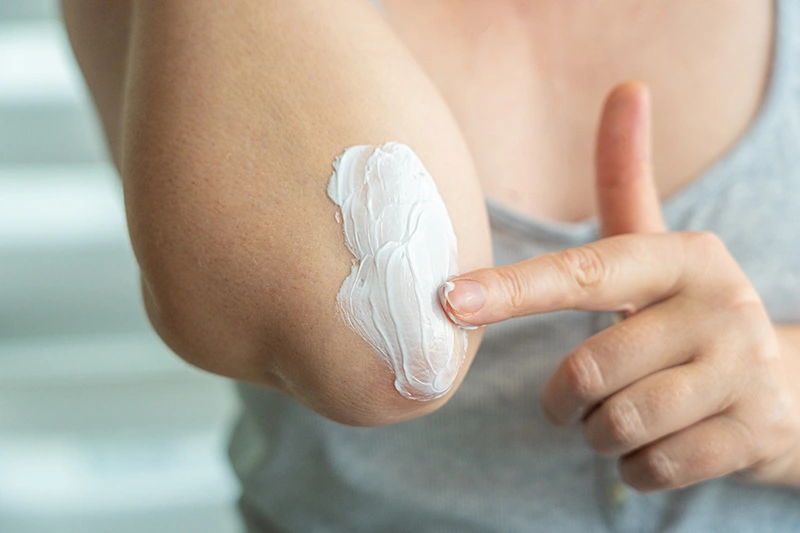 A patient applying cream to their elbow to treat eczema.